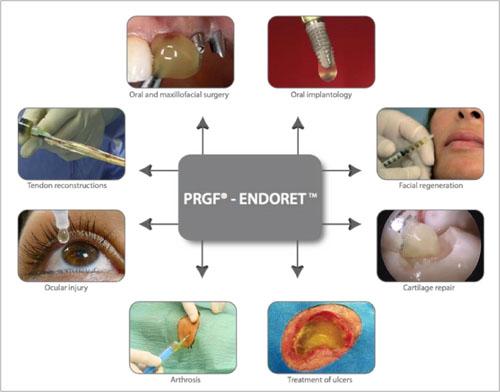 Some examples of the therapeutic potential of endogenous regenerative technology.